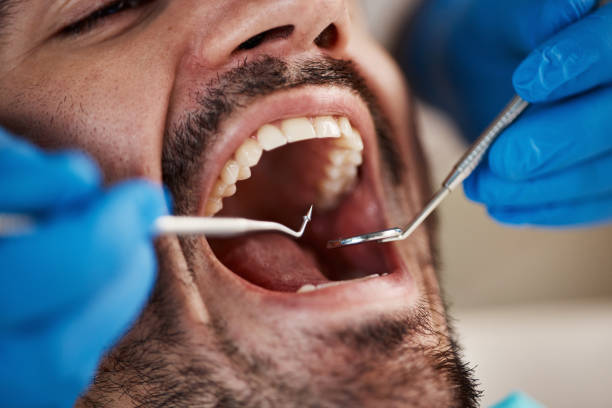 Emergency Dental Services in Yountville, CA